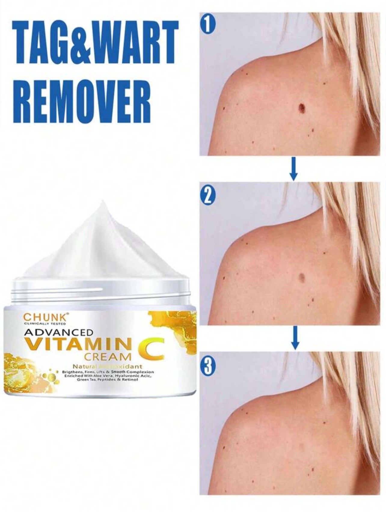 Tag&Wart Remover