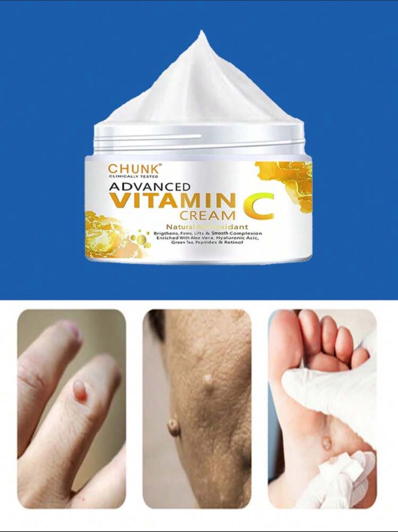 Tag&Wart Remover