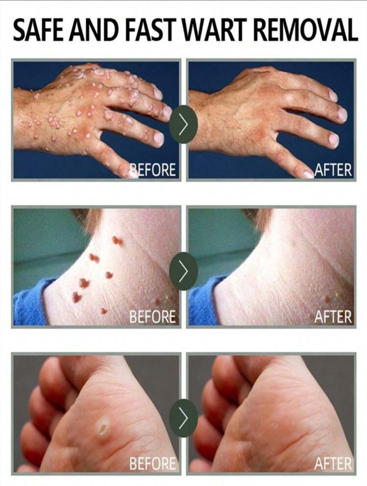 Tag&Wart Remover