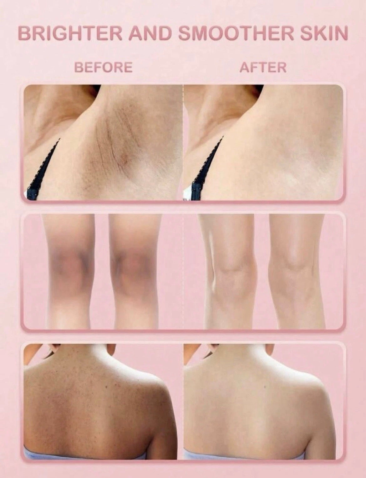 Hydrating Body & Face Cream for Uneven Skin | Brightening & Smoothing Moisturizer