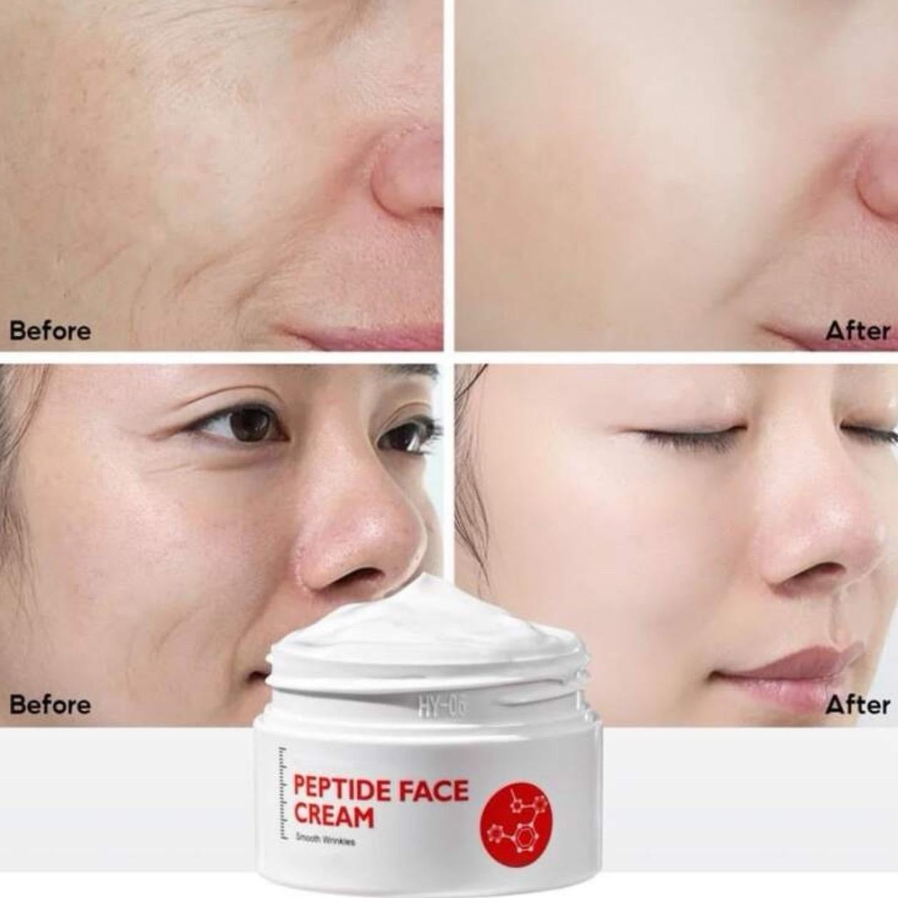Collagen Pure Face Cream - Anti-Aging, Wrinkle-Lift, Firming, Acne-Reducing, Moisturizing, and Nourishing