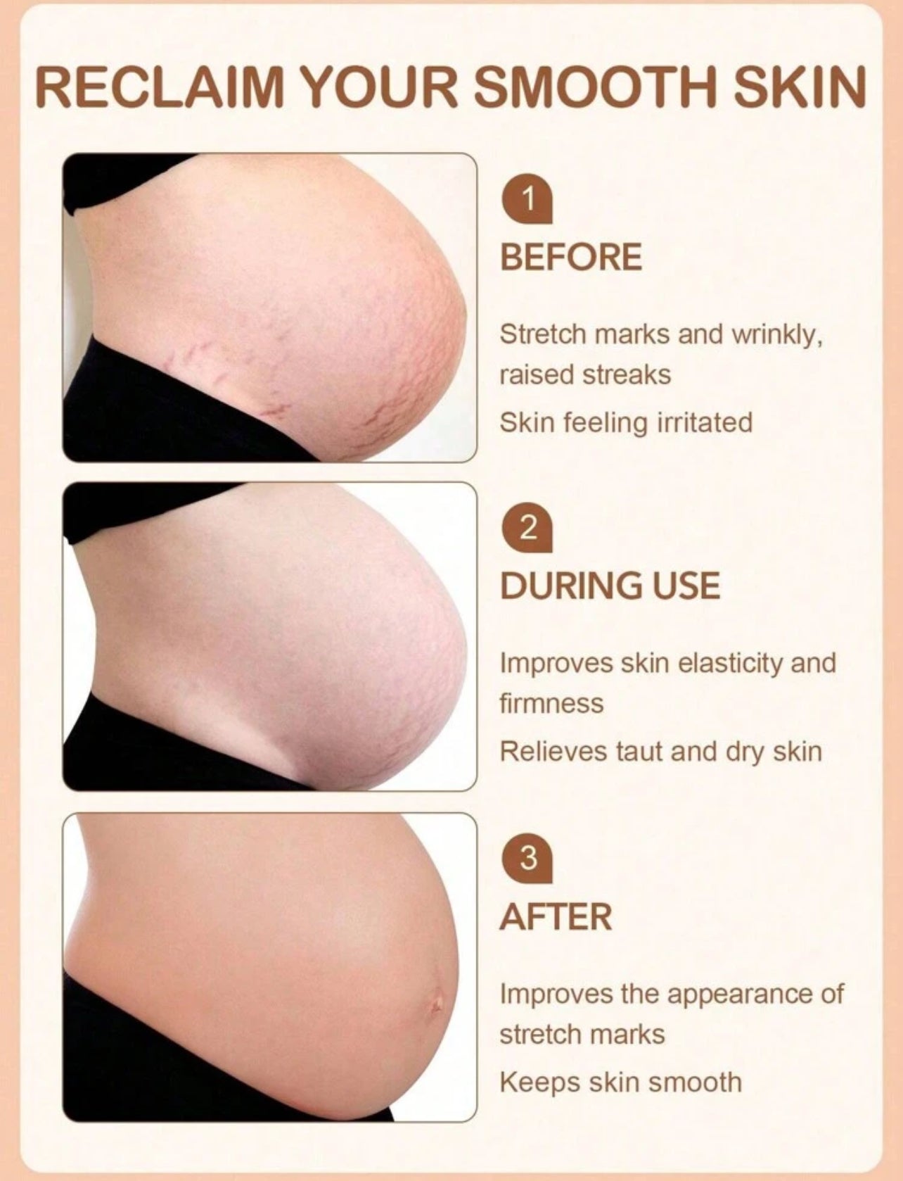 Stretch marks serum vitamin E