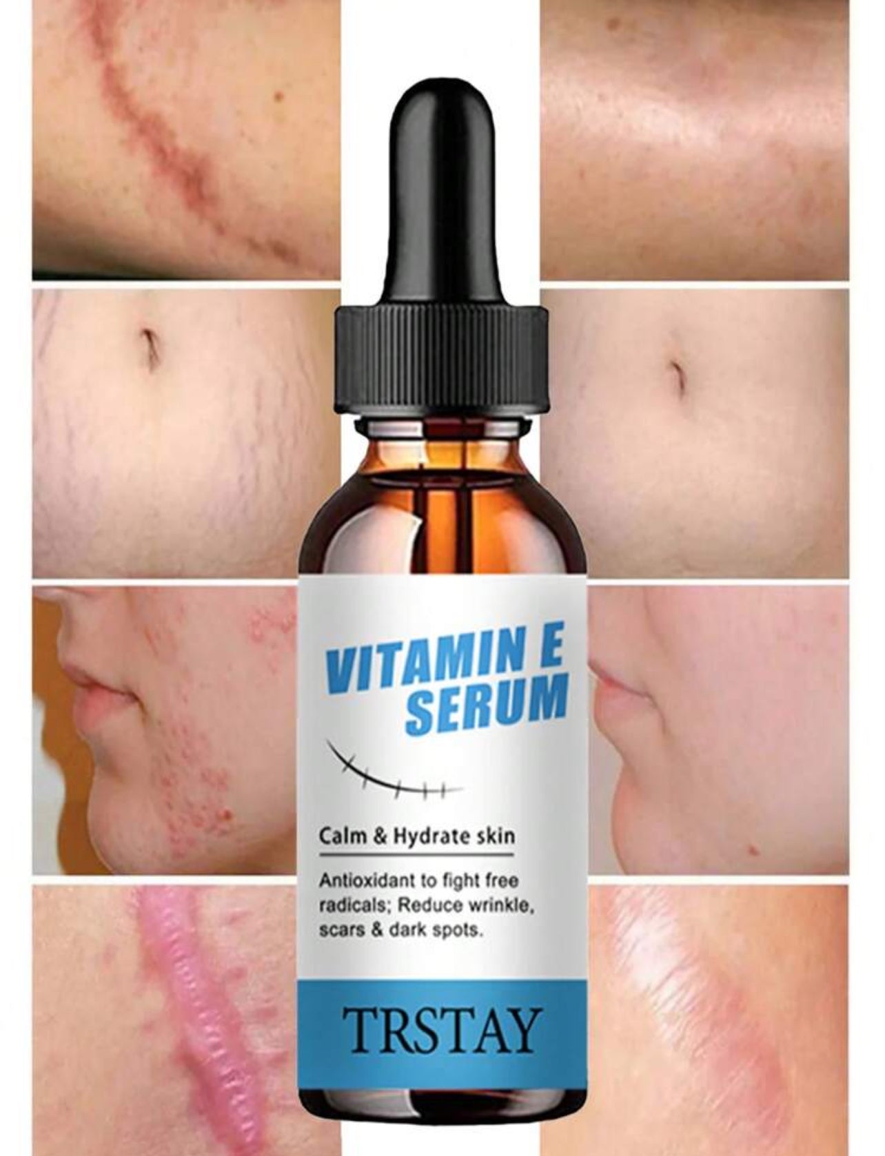 Stretch marks serum vitamin E