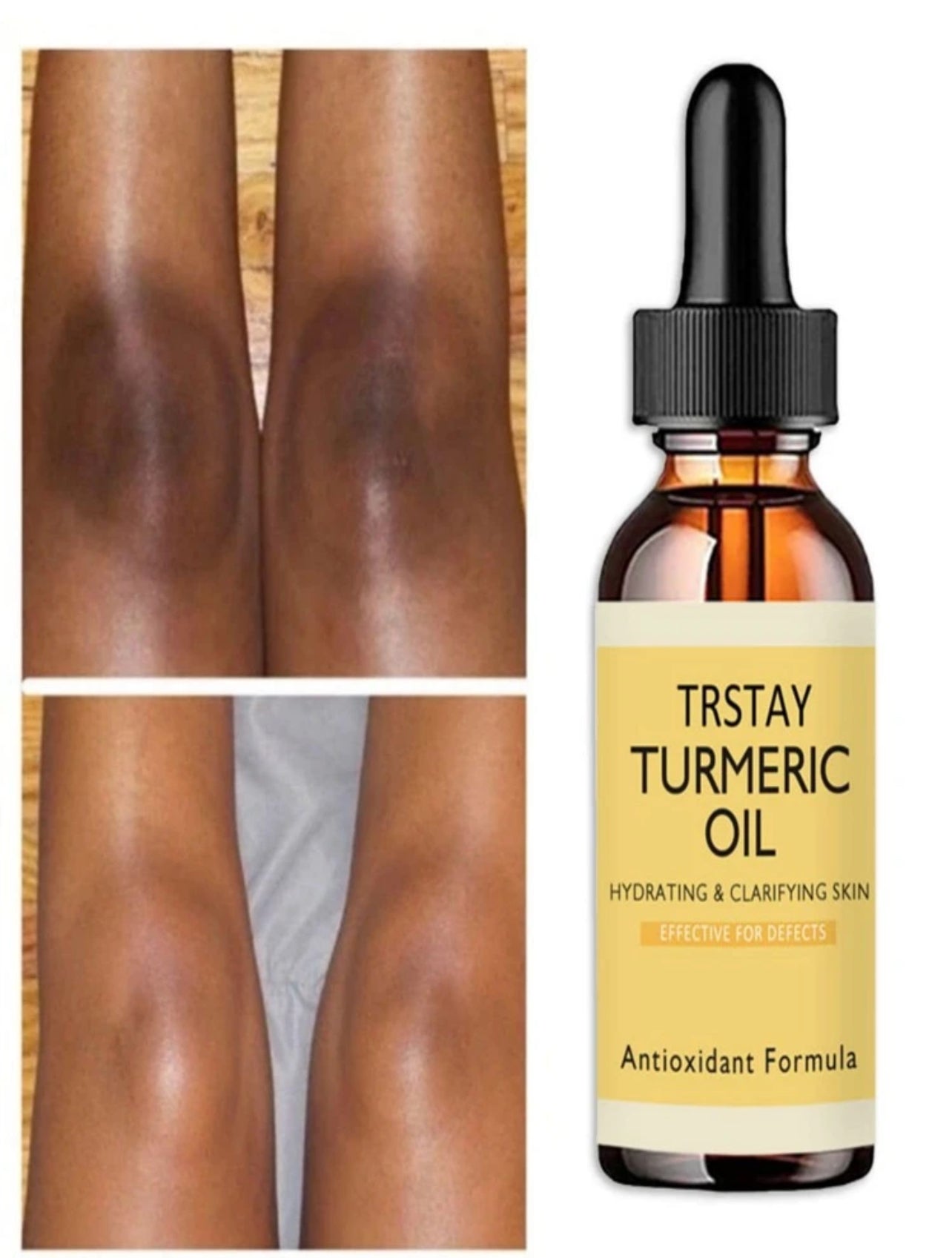 Turmeric oil dark spots Remover