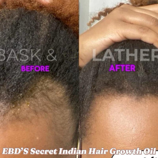 EBD's Secret Indian Hair Growth Oil - Haircare Treatment for Enhanced Comfort and Growth